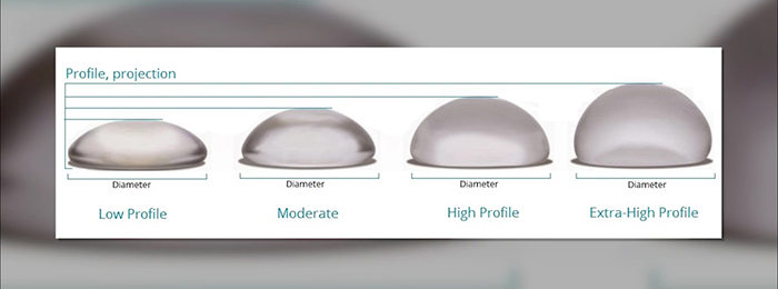 Differences in silicone implants.