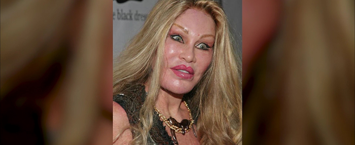 Bad Botox.