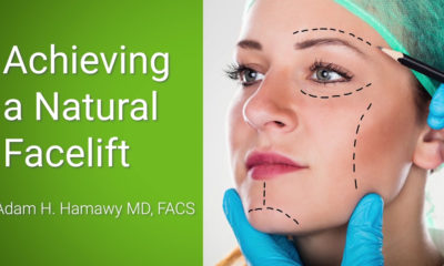 What to know before getting a facelift.