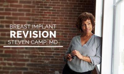 Breast augmentation revision and GalaFORM 3D.