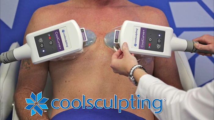 CoolSculpting for gynecomastia.