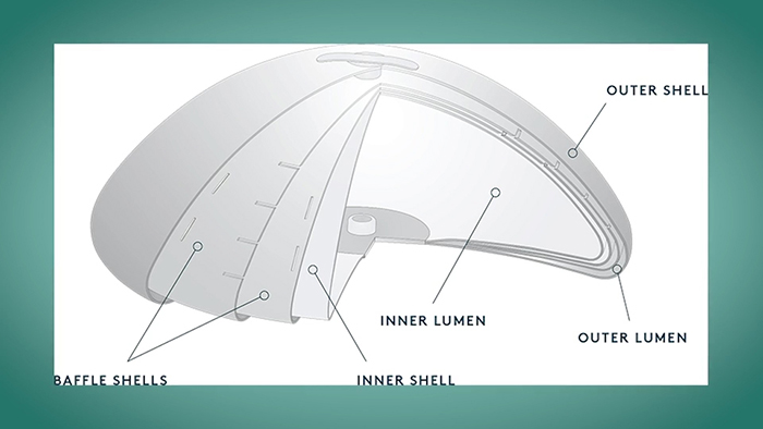 The IDEAL implant's baffle system.