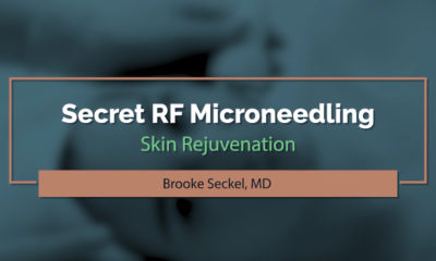 Treat wrinkles, lines, and scars using 'secret' RF microneedling.