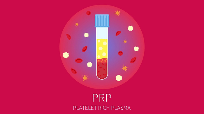 Regenerative medicine - PRP.