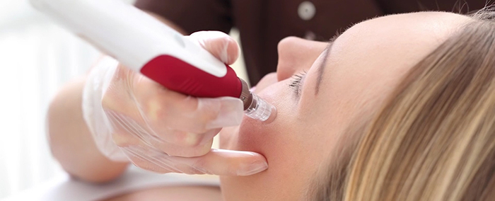 Using PRP for facial rejuvenation.