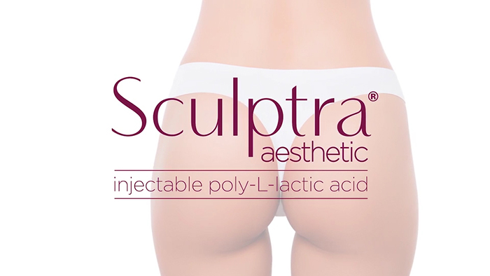Sculptra for buttock augmentation.