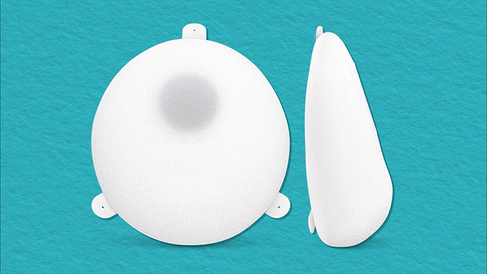 Tissue expanders.