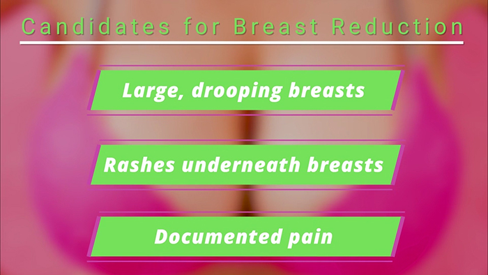Reasons for breast reduction.