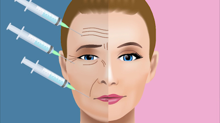 Features of Botox.