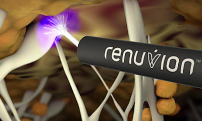 How Renuvion May Revolutionize Non-Surgical Skin Tightening.