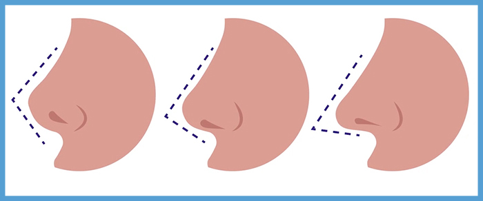 Nose shapes.