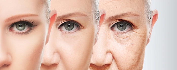 Eyelid aging progression.