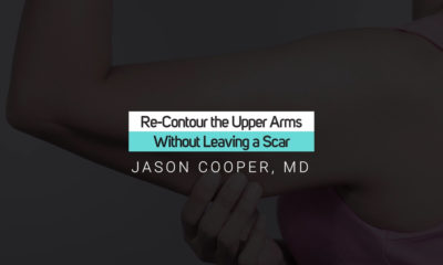 Upper Arm Tightening Without Scars.