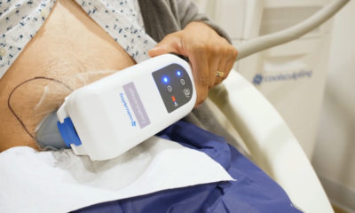 Male Call: CoolSculpting is Hot For Men
