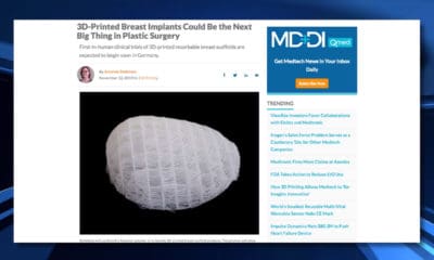 No Spin Live Episode 83 - 3D Printed, Absorbable Breast Implants